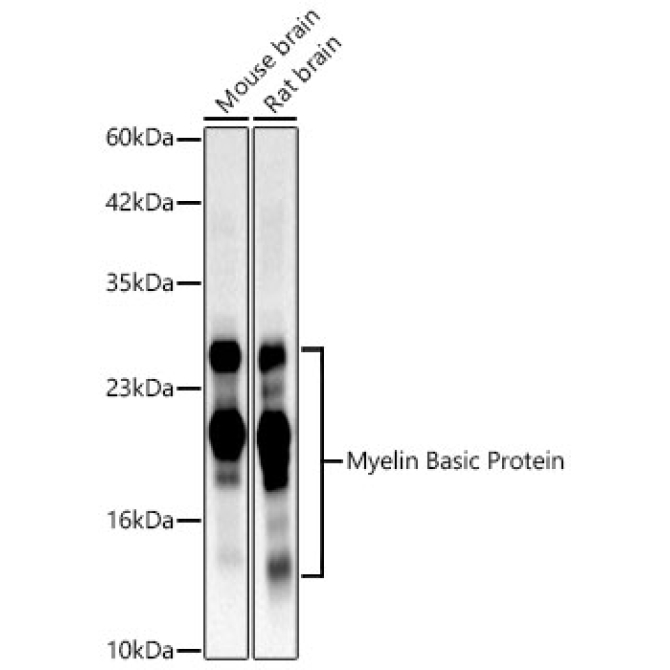 Myelin Basic Protein Rabbit Monoclonal Antibody
