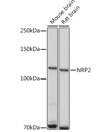 NRP2 Rabbit Polyclonal Antibody