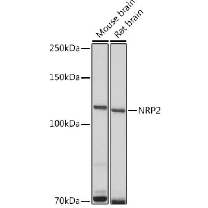NRP2 Rabbit Polyclonal Antibody