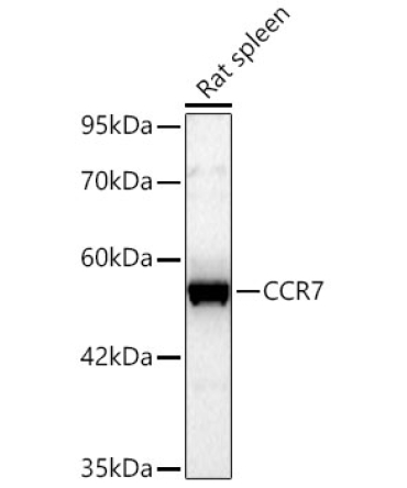 CCR7 Rabbit Polyclonal Antibody