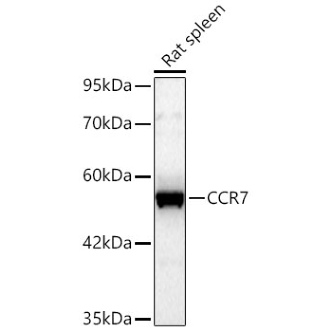 CCR7 Rabbit Polyclonal Antibody