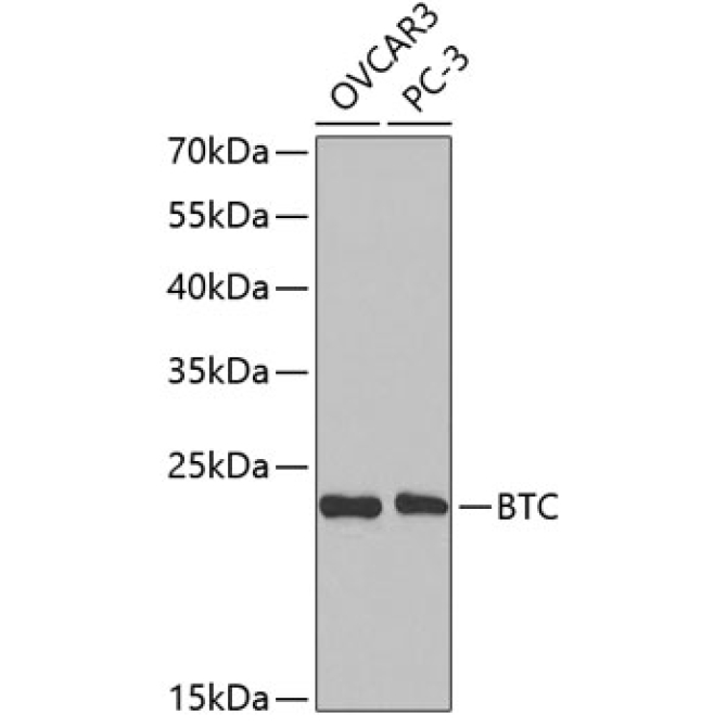 BTC Rabbit Polyclonal Antibody