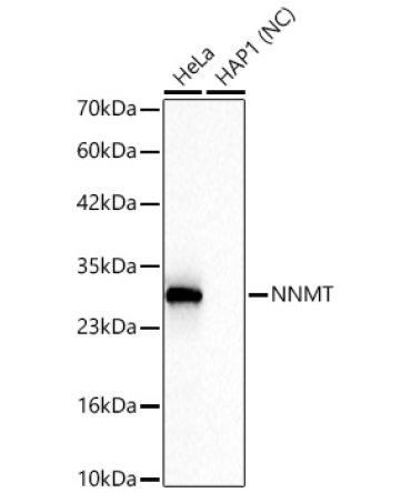 NNMT Rabbit PolyMonoclonal Antibody?