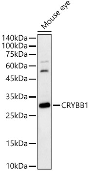 CRYBB1 Rabbit Polyclonal Antibody