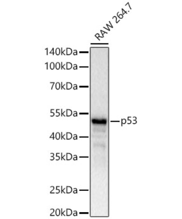 p53 Rabbit Monoclonal Antibody