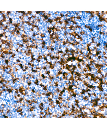 CD43 Rabbit Monoclonal Antibody
