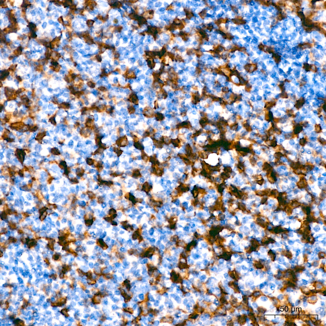 CD43 Rabbit Monoclonal Antibody