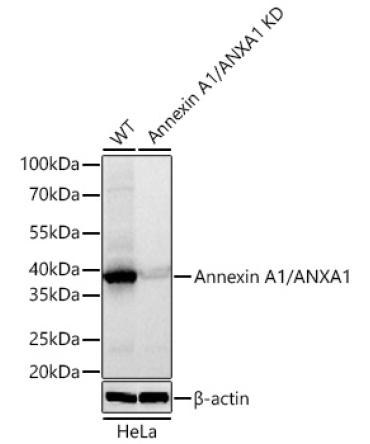 Annexin A1/ANXA1 Rabbit Monoclonal Antibody [KD Validated]