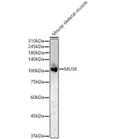 MUSK Rabbit Polyclonal Antibody