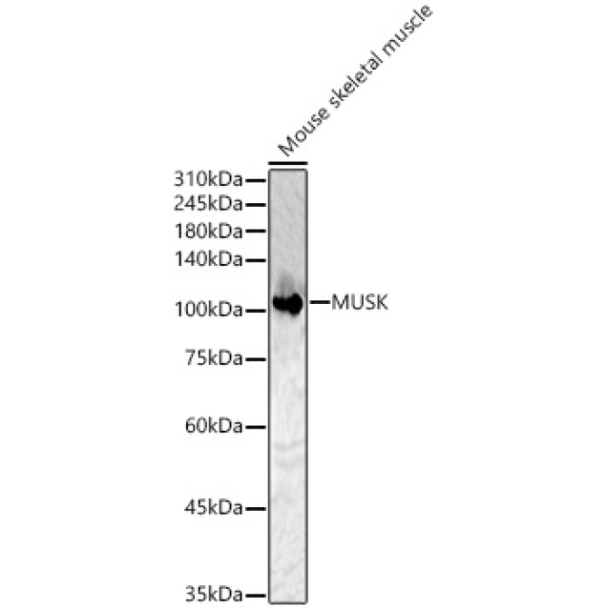 MUSK Rabbit Polyclonal Antibody