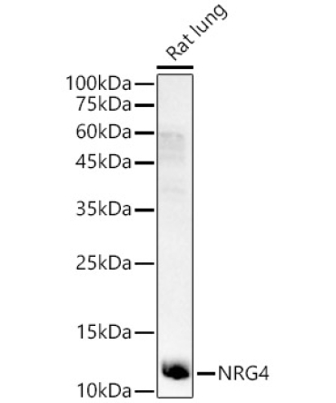 NRG4 Rabbit Polyclonal Antibody