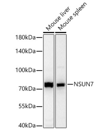 NSUN7 Rabbit Polyclonal Antibody