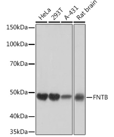 FNTB Rabbit Monoclonal Antibody