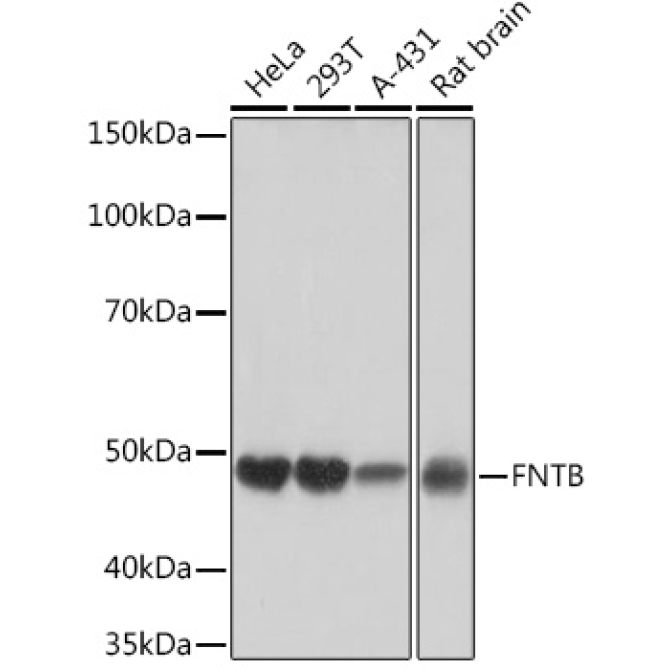 FNTB Rabbit Monoclonal Antibody
