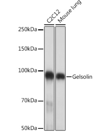 Gelsolin Rabbit Monoclonal Antibody