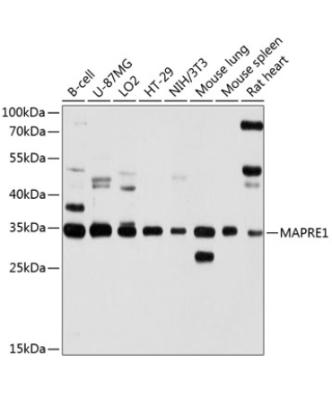 MAPRE1 Rabbit Polyclonal Antibody