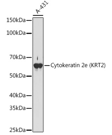 Cytokeratin 2e (KRT2) Rabbit Monoclonal Antibody
