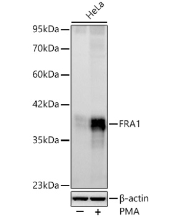 FRA1 Rabbit Monoclonal Antibody