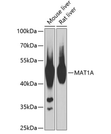 MAT1A Rabbit Polyclonal Antibody