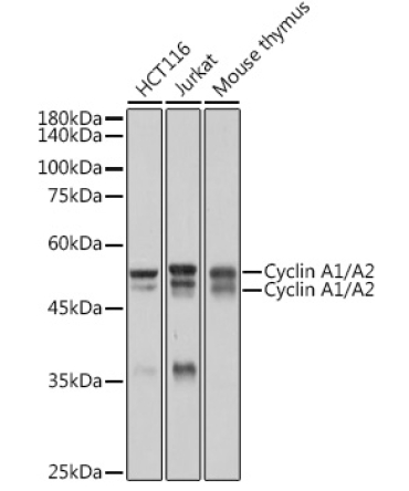 Cyclin A1/A2 Rabbit Monoclonal Antibody