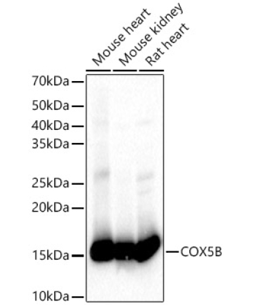 COX5B Rabbit Polyclonal Antibody