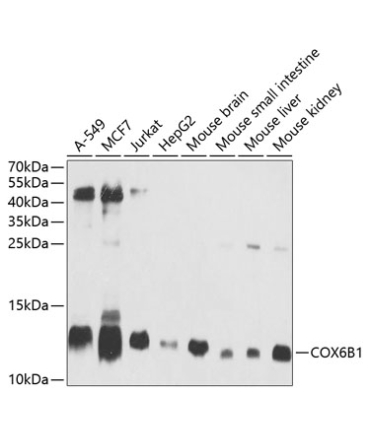 COX6B1 Rabbit Polyclonal Antibody
