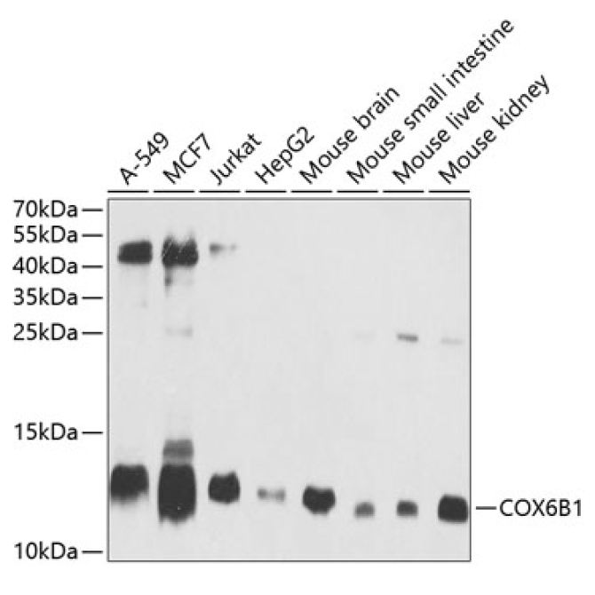 COX6B1 Rabbit Polyclonal Antibody