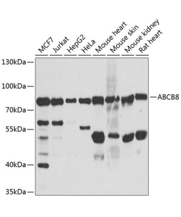 ABCB8 Rabbit Polyclonal Antibody