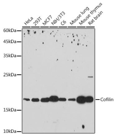 Cofilin Rabbit Monoclonal Antibody