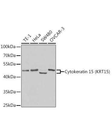 Cytokeratin 15 (KRT15) Rabbit Polyclonal Antibody