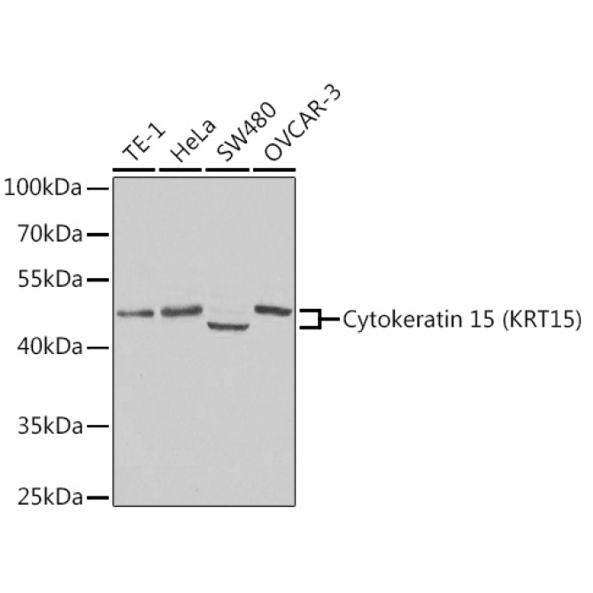 Cytokeratin 15 (KRT15) Rabbit Polyclonal Antibody