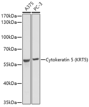 Cytokeratin 5 Rabbit Polyclonal Antibody