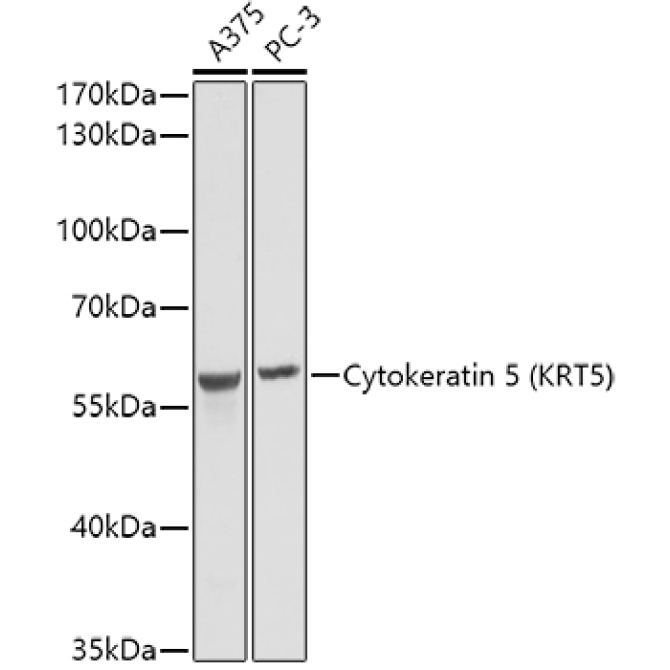 Cytokeratin 5 Rabbit Polyclonal Antibody
