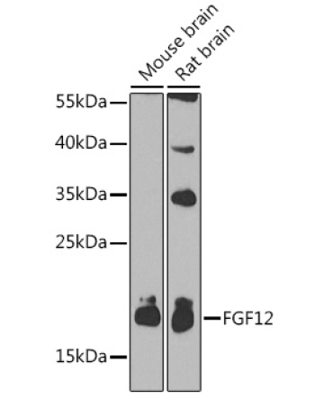 FGF12 Rabbit Polyclonal Antibody