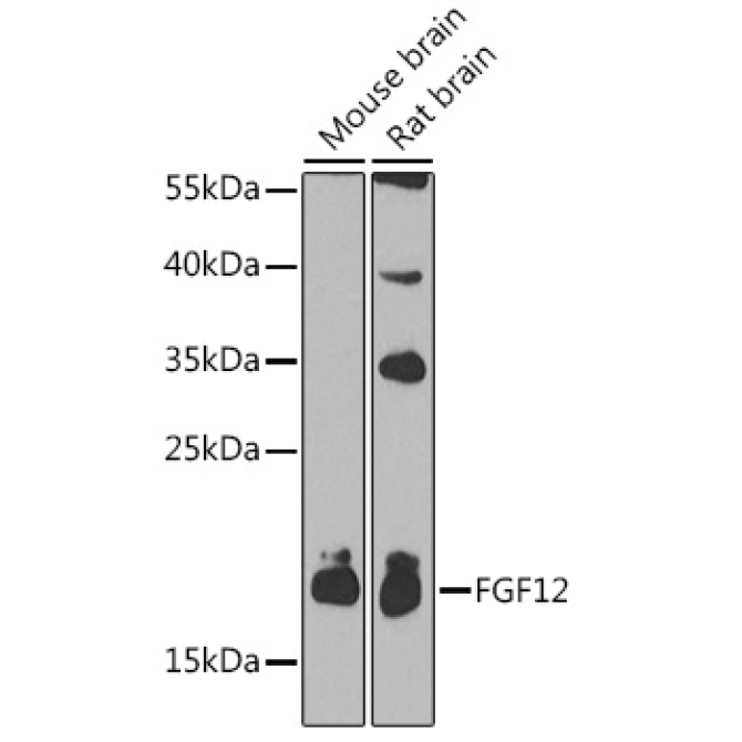 FGF12 Rabbit Polyclonal Antibody