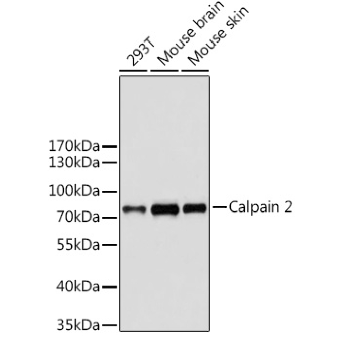 Calpain 2 Rabbit Polyclonal Antibody