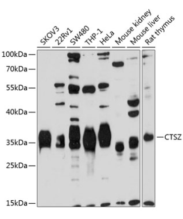 CTSZ Rabbit Polyclonal Antibody