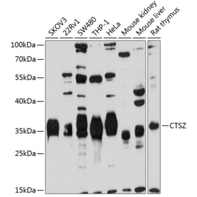 CTSZ Rabbit Polyclonal Antibody