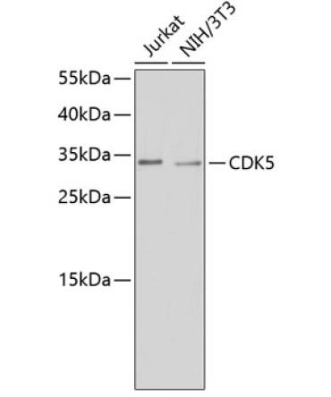 CDK5 Rabbit Polyclonal Antibody