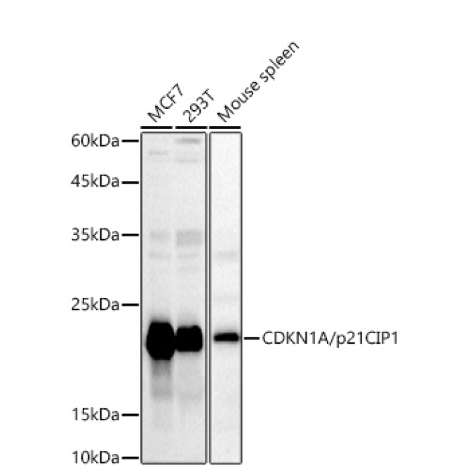CDKN1A/p21CIP1 Rabbit Polyclonal Antibody