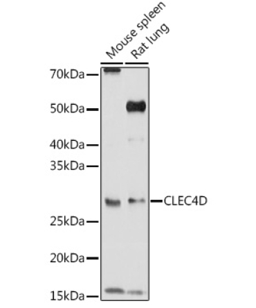 CLEC4D Rabbit Polyclonal Antibody