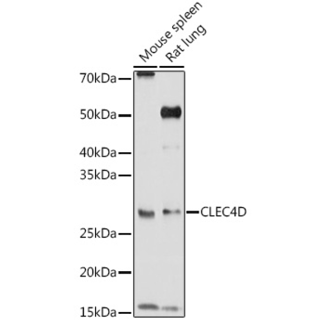CLEC4D Rabbit Polyclonal Antibody