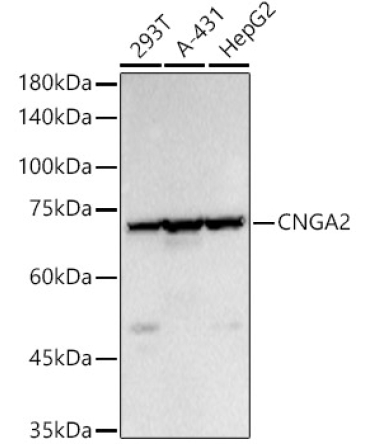 CNGA2 Rabbit Polyclonal Antibody