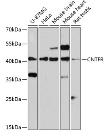 CNTFR Rabbit Polyclonal Antibody