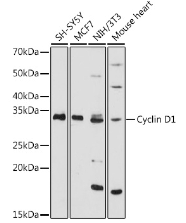Cyclin D1 Rabbit Polyclonal Antibody