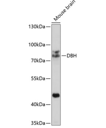 DBH Rabbit Polyclonal Antibody