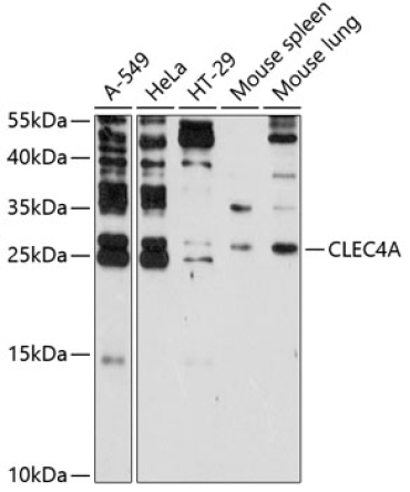 CLEC4A Rabbit Polyclonal Antibody