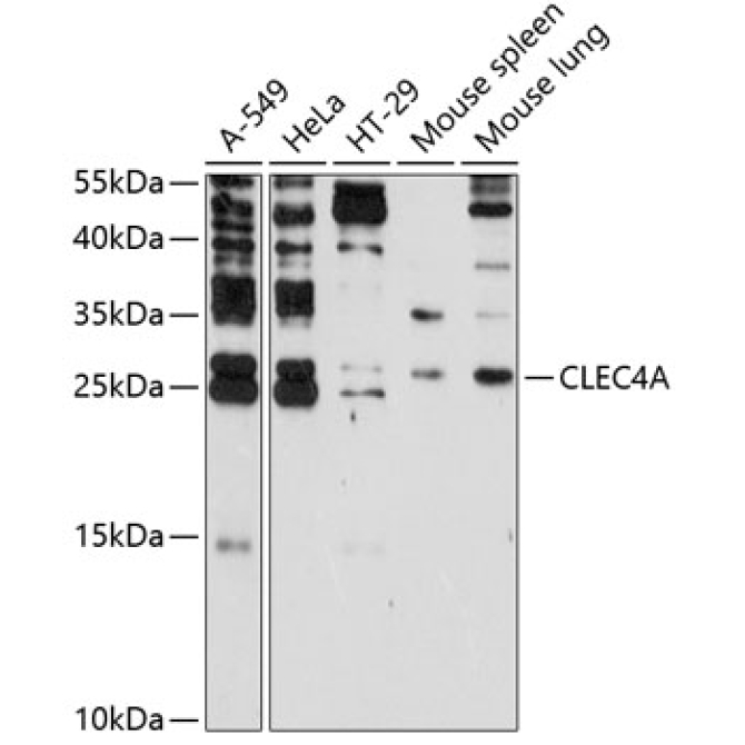 CLEC4A Rabbit Polyclonal Antibody