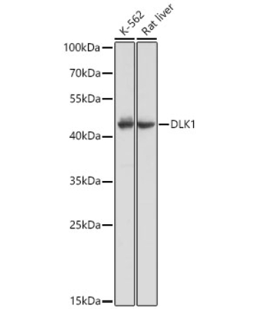 DLK1 Rabbit Polyclonal Antibody