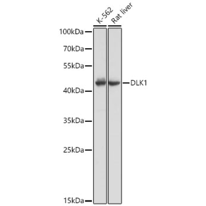DLK1 Rabbit Polyclonal Antibody